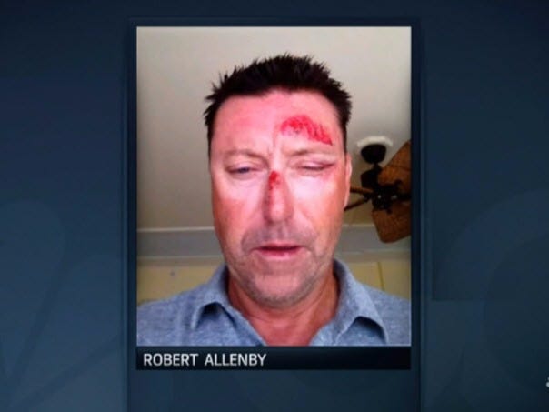 Robert Allenby